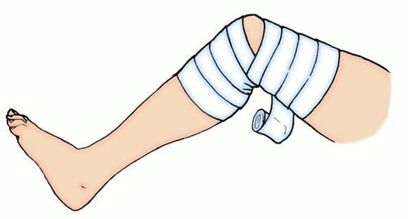 Elastic dressing